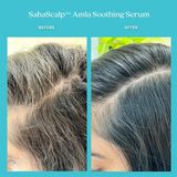 Serum Dưỡng Tóc Gàu Fable & Mane Sahascalp ™ Amla Soothing Serum 5ml