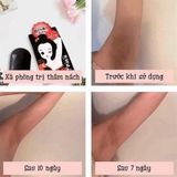 Xà Phòng Pelican Trị Thâm Nách Nhật Bản 100g