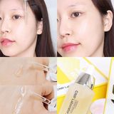Tinh Chất Keo Ong CNP Laboratory Propolis Energy Ampule 50ml - Túi Refill