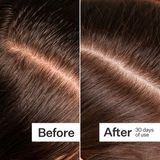 Tinh chất giảm ngứa và gàu da đầu Act+Acre Microbiome Cooling Scalp Serum For Dry Itchy Scalp + Loose Flakes 15ml