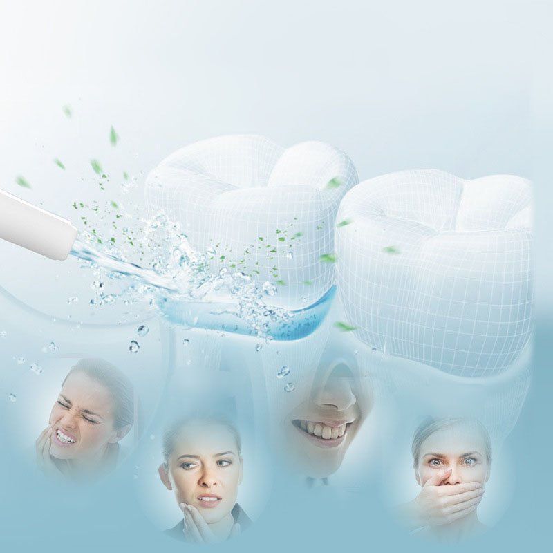 Bộ Đầu Xịt Máy Tăm Nước Mocato