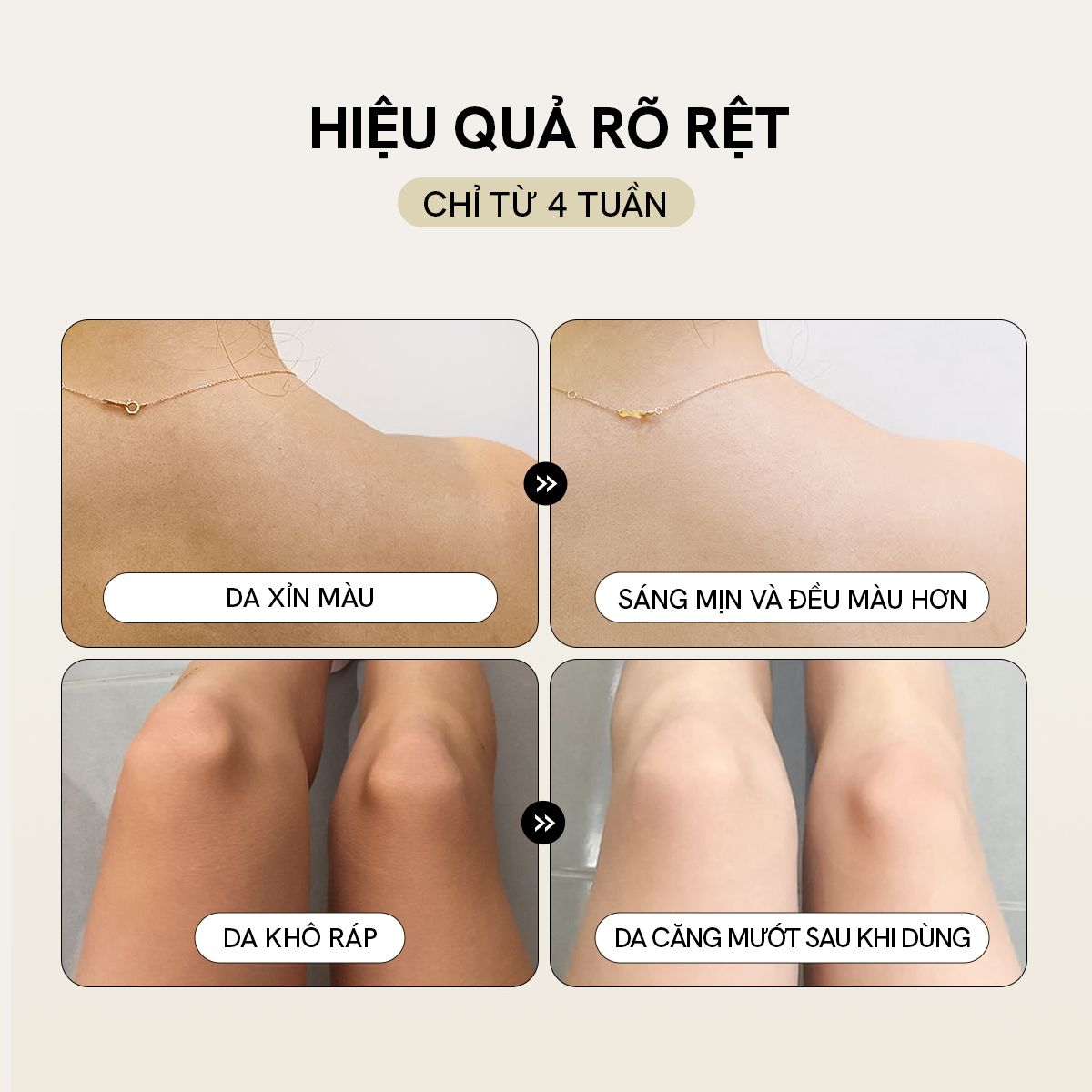Bộ Đôi Sữa Tắm Và Dưỡng Thể Trắng Da Hương Nước Hoa Thư Giãn (2x300ml)