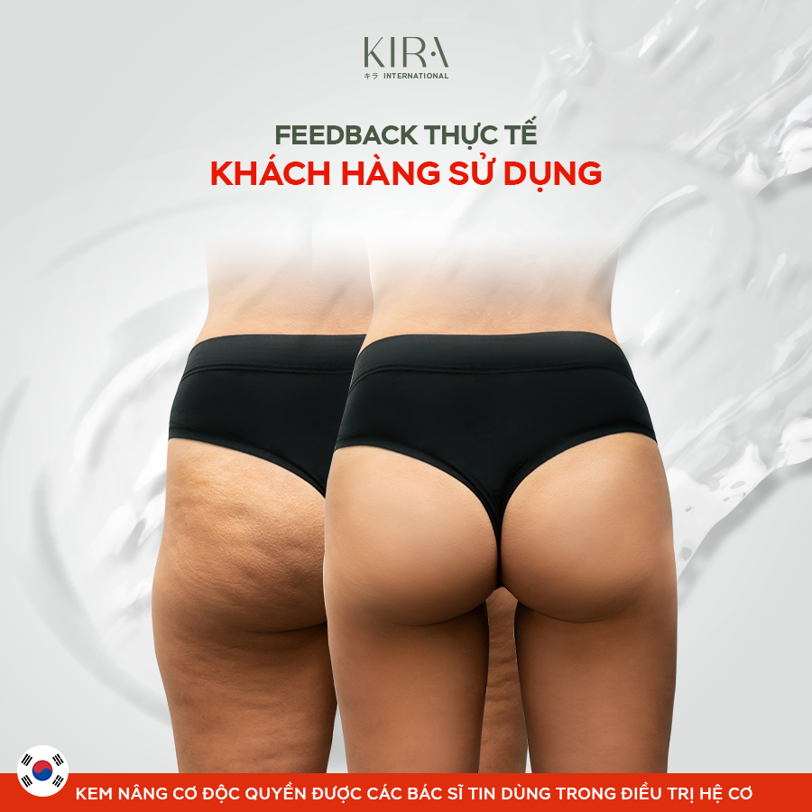 Kem Nâng Cơ Kira Joint Care Complex Cream - Giảm Nếp Nhăn, Tăng sinh Collagen 48g