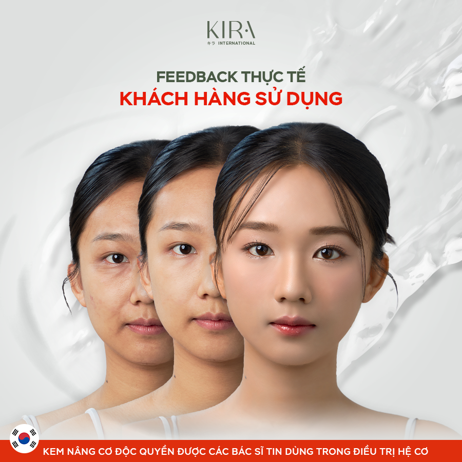 Kem Nâng Cơ Kira Joint Care Complex Cream - Giảm Nếp Nhăn, Tăng sinh Collagen 48g