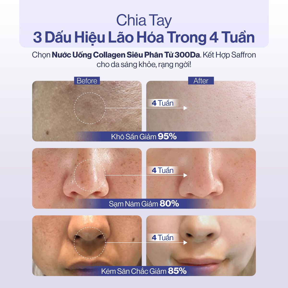  Combo 2 Nước Uống Collagen Gilaa Siêu Phân Tử 300DA (20g x 30 gói) 