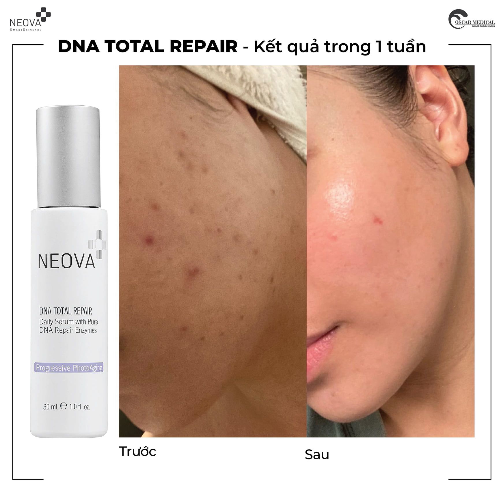 Serum Phục Hồi Toàn Diện DNA Total Repair Neova