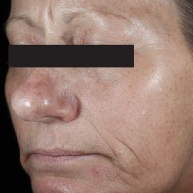 Serum Vitamin C Chống Oxy Hoá Da Thường C E Ferulic Skinceuticals