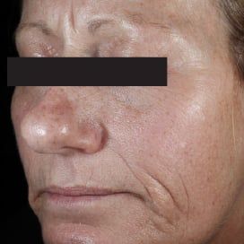 Serum Vitamin C Chống Oxy Hoá Da Thường C E Ferulic Skinceuticals