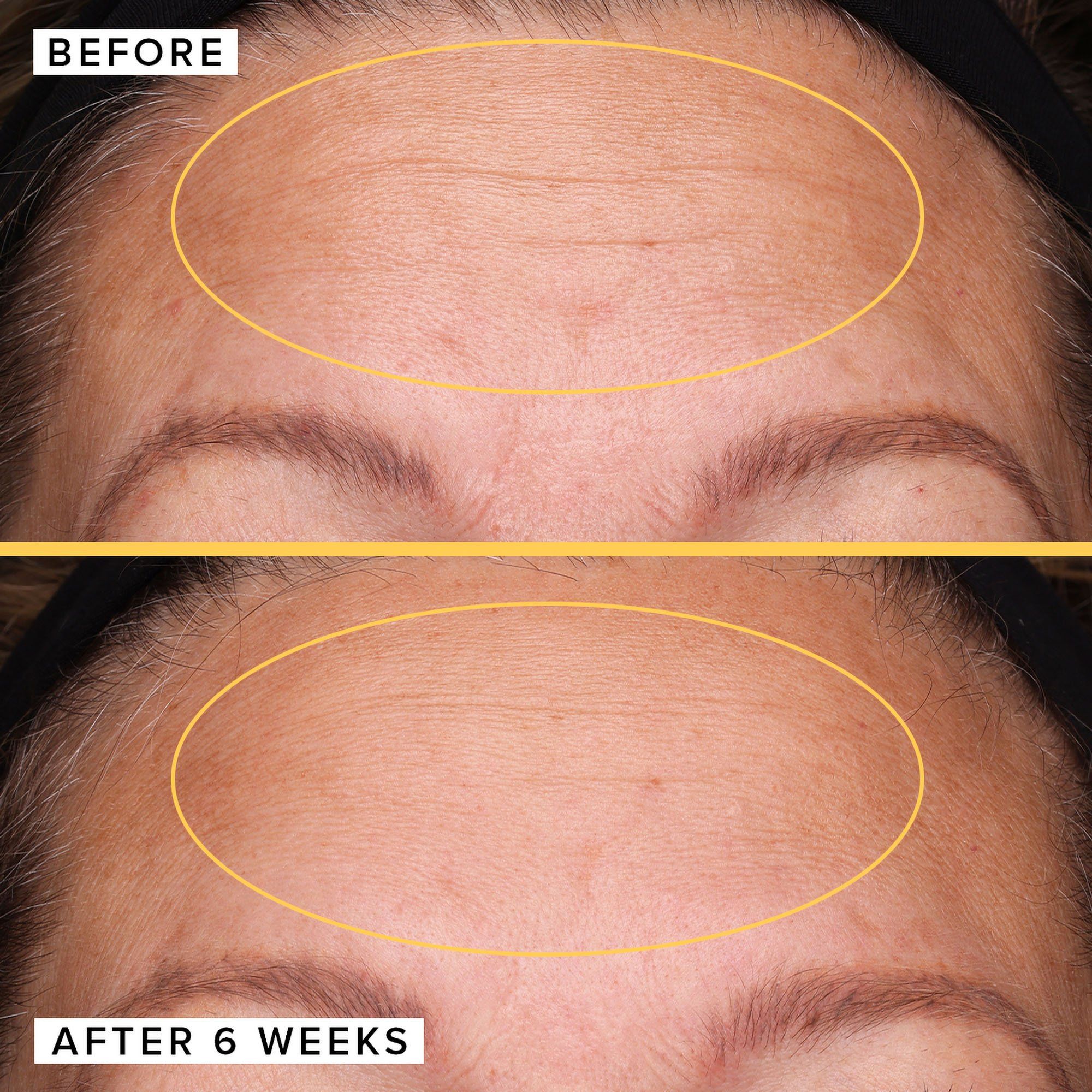 Serum Làm Đầy Filling Good Hyaluronic Acid Plumping Farmacy