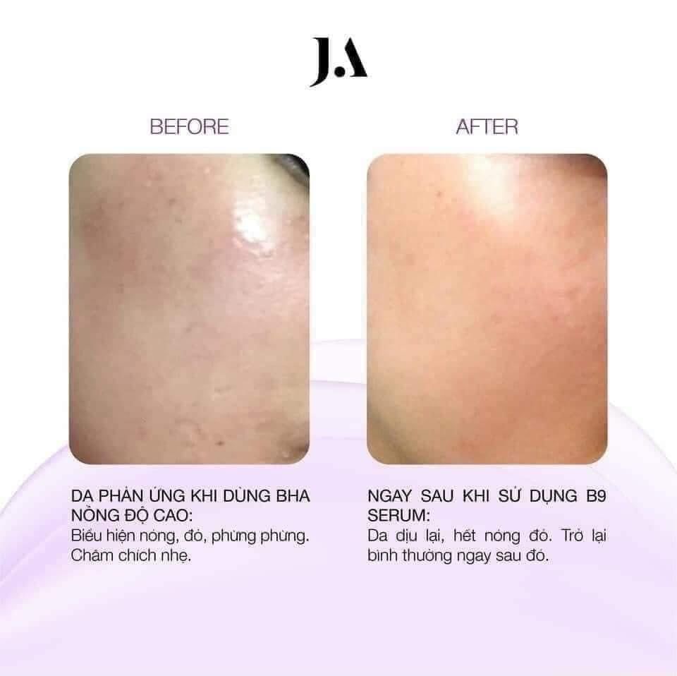 Serum Phục Hồi Chống Kích Ứng Folic Acid B9 Juliette Armand