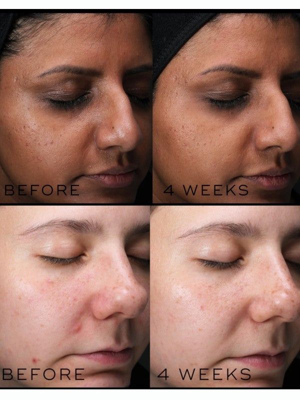 Serum Sáng Da Niacinamide 10% Medik8 Clarity Peptides