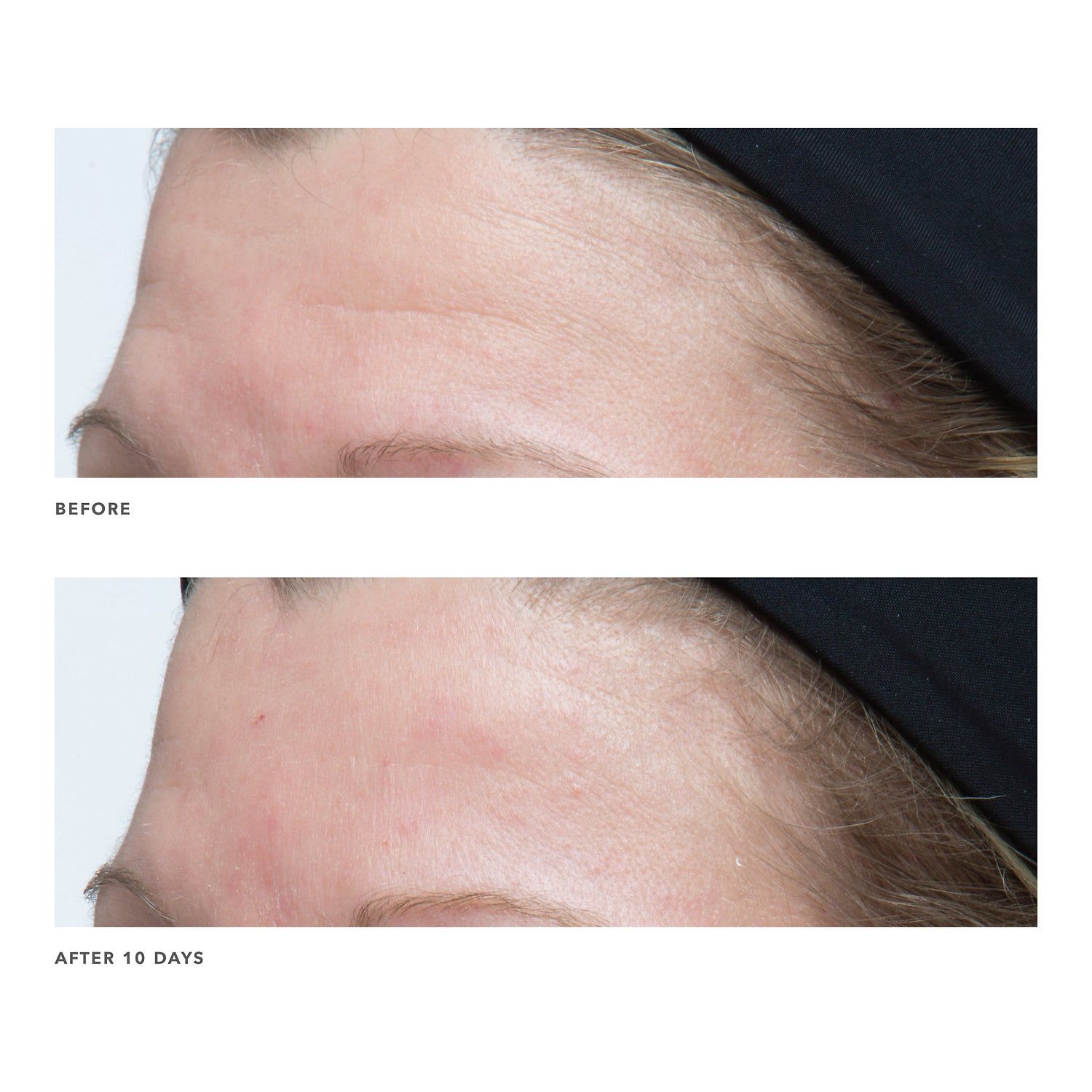 Kem Chống Lão Hoá Algenist Genius Ultimate Anti-Aging Cream