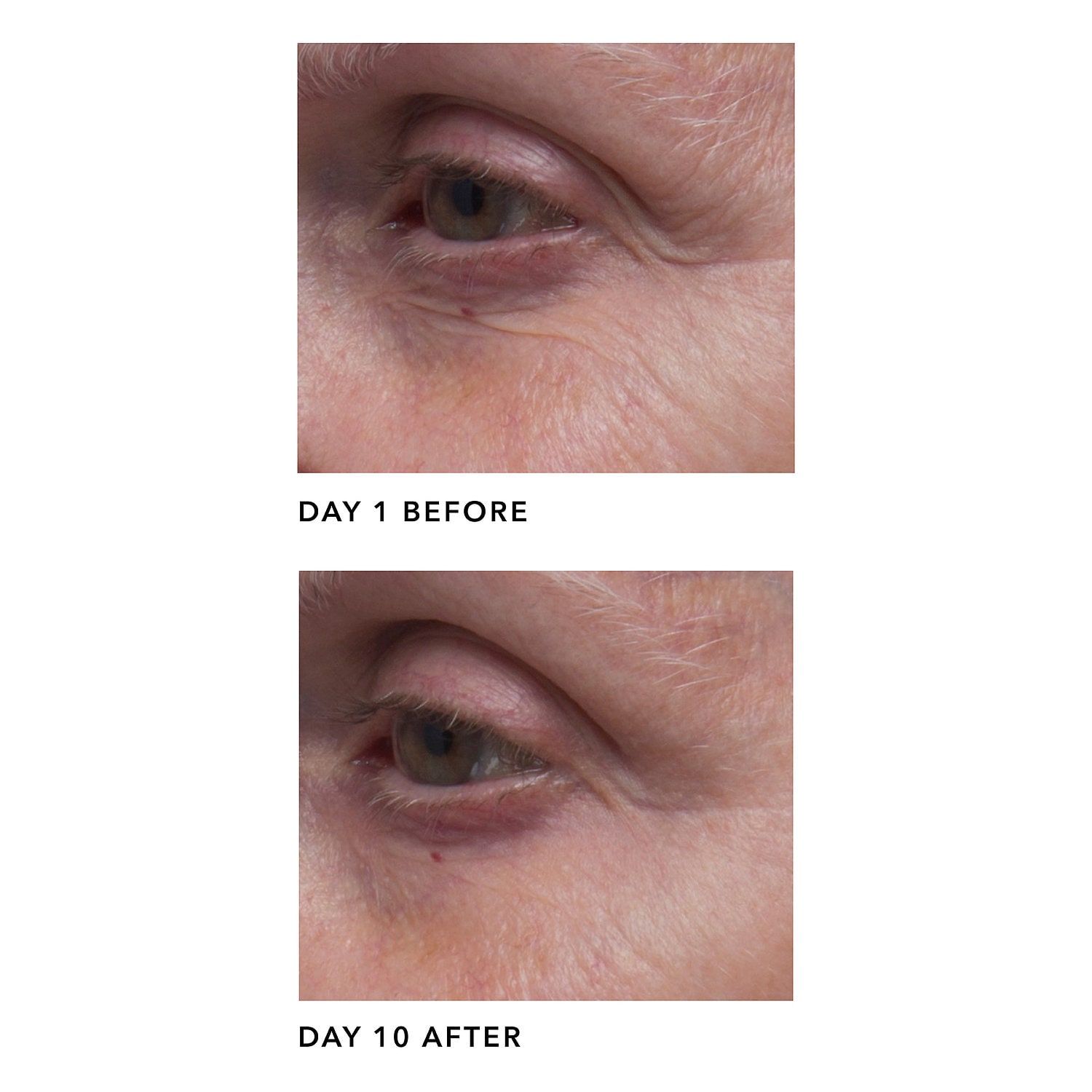 Serum Phục Hồi Trong 10 Ngày Algenist AA Barrier