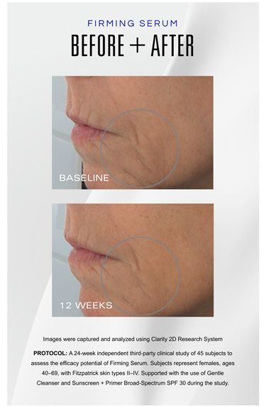 Serum Nâng Cơ Firming Serum Zo Skin Health