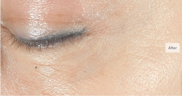 Serum Chống Lão Hoá Mắt Retinol Ferulic Triple Correction Dr Dennis Gross