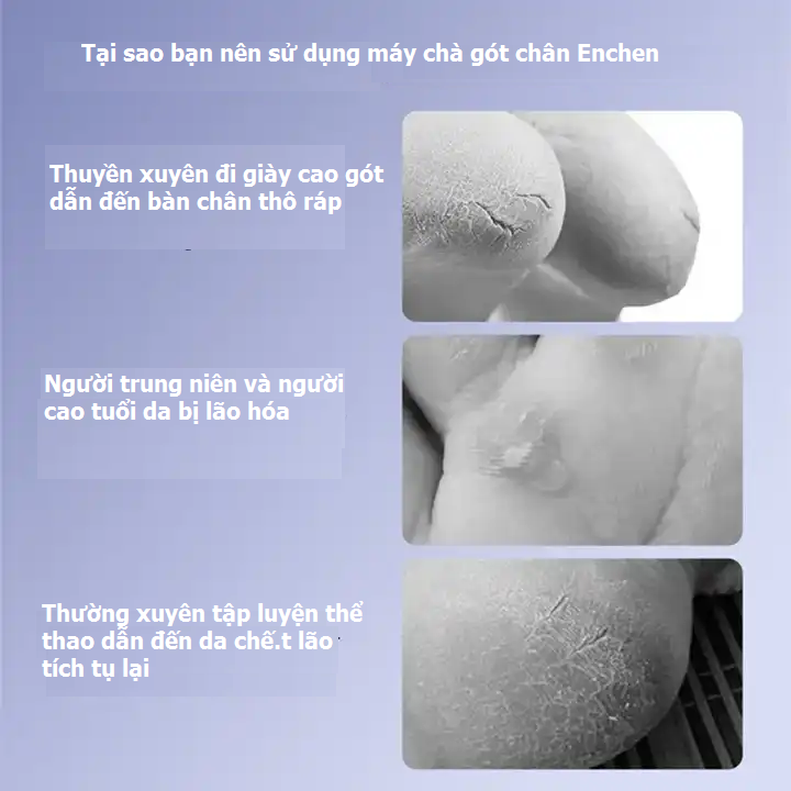 Máy chà gót chân Enchen OVIE ROCK tẩy tế bào chết, làm mềm sáng gót chân chuyên dụng tại nhà