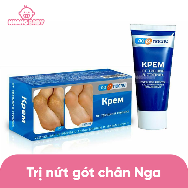 Kem nứt gót chân Kpem Nga