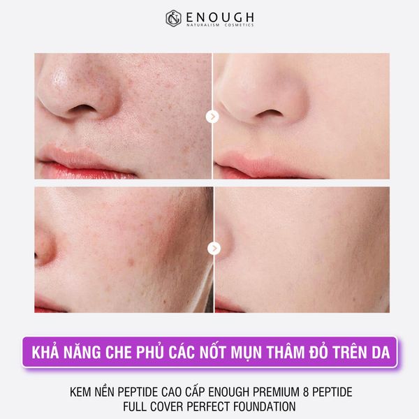 KEM NỀN PEPTIDE CAO CẤP ENOUGH PREMIUM 8 PEPTIDE FULL COVER PERFECT FOUNDATION 100ML