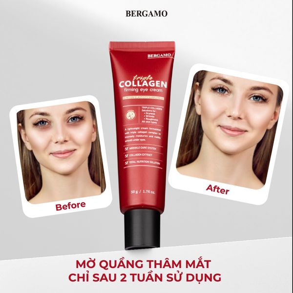 KEM DƯỠNG MẮT COLLAGEN SĂN CHẮC BERGAMO TRIPLE COLLAGEN FIRMING EYE CREAM 50G