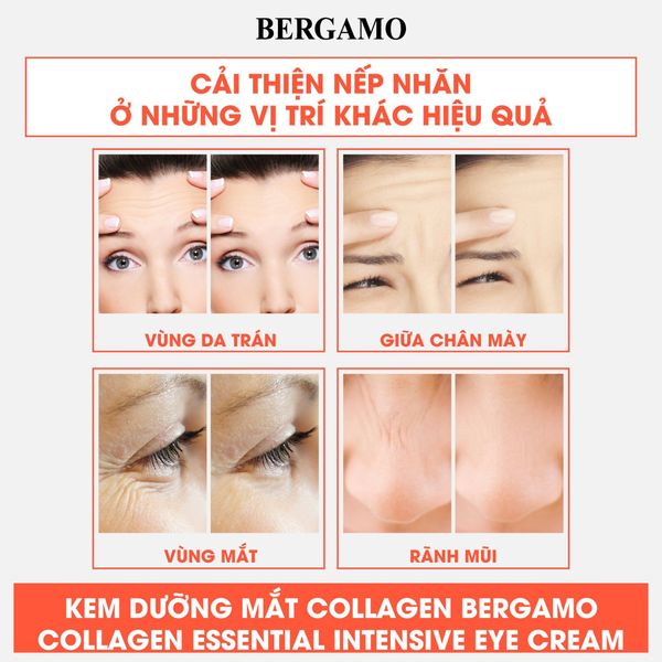 KEM DƯỠNG MẮT BERGAMO ESSENTIAL INTENSIVE EYECREAM 100G