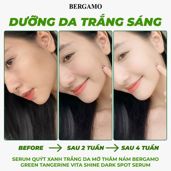 SERUM QUÝT XANH TRẮNG DA MỜ THÂM NÁM BERGAMO GREEN TANGERIN VITA SHINE DARK SPOT SERUM 50ML