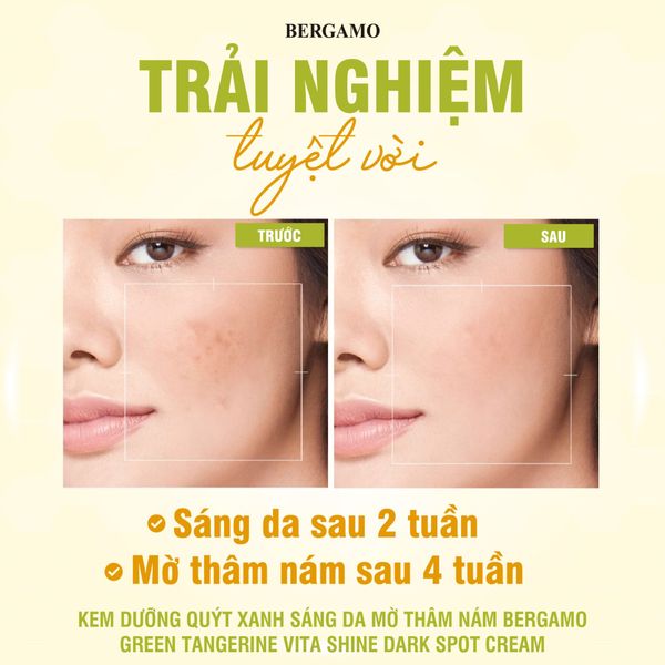 KEM DƯỠNG QUÝT XANH TRẮNG DA MỜ THÂM NÁM BERGAMO GREEN TANGERIN VITA SHINE DARK SPOT CREAM 50G