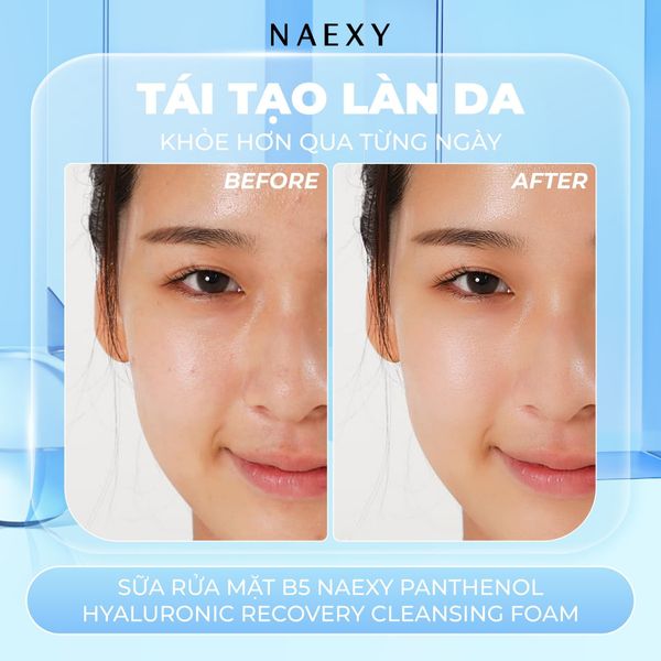 SỮA RỬA MẶT NAEXY RECOVERY CLEANSING FOAM 100ML