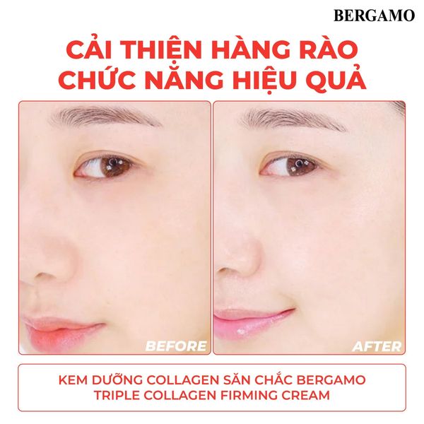 KEM DƯỠNG COLLAGEN SĂN CHẮC BERGAMO TRIPLE COLLAGEN FIRMING CREAM 50G