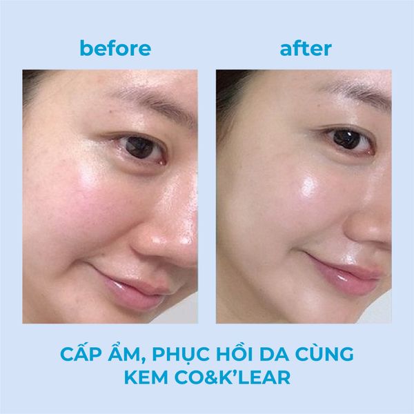 KEM CO & KLEAR B3+B5 COLLAGEN REPAIR CREAM 50ML