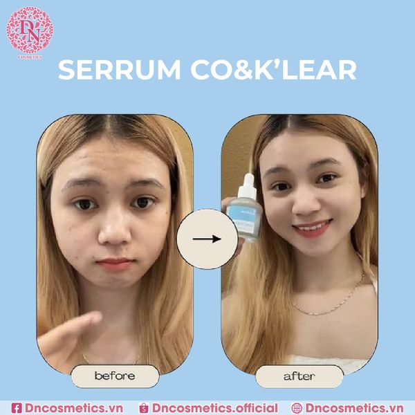 SERUM CO & KLEAR NIACINAMIDE 20% AMPOULE 30ML