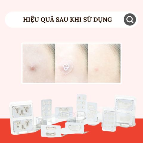  Miếng dán mụn với miếng Magie thần kỳ LAPNPEOPLE tái tạo chăm sóc da 15 miếng 