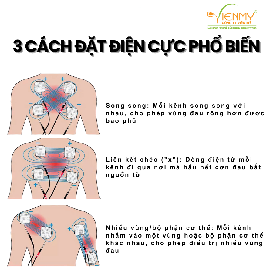 Máy giảm đau, thư giãn cơ tại nhà StimPro 4X ZENTEK