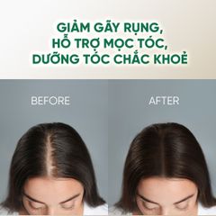Dầu gội dưỡng tóc PURA D'OR Original Gold Label Anti - Hair Thinning Shampoo 473ml