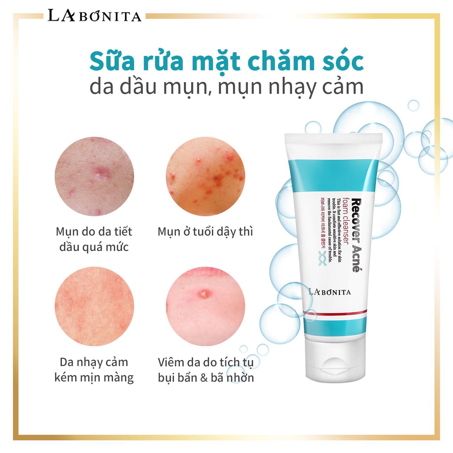  Sữa Rửa Mặt Cho Da Dầu Mụn La Bonita Recover Acne Foam Cleanser 100ml - tặng 2 mask 