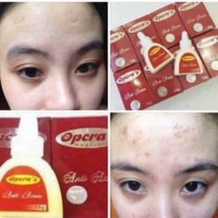 Kem Mụn Hiệu Quả Opera Anti Acnes 12gr