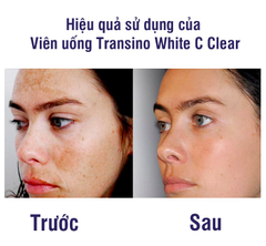 Viên Uống Trắng Da Transino White C Clear 120 Viên ( Mẫu Mới )