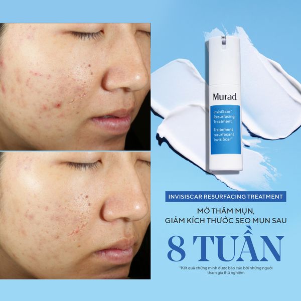 ACNE - Kem mờ sẹo và tái tạo nền da  InvisiScar Resurfacing Treatment 15ml