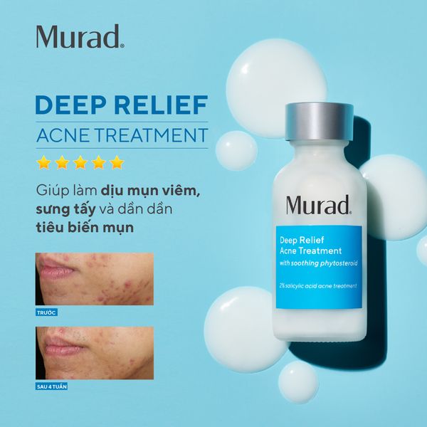 ACNE - Dung dịch giảm mụn chuyên sâu  Deep Relief Acne Treatment 30ml