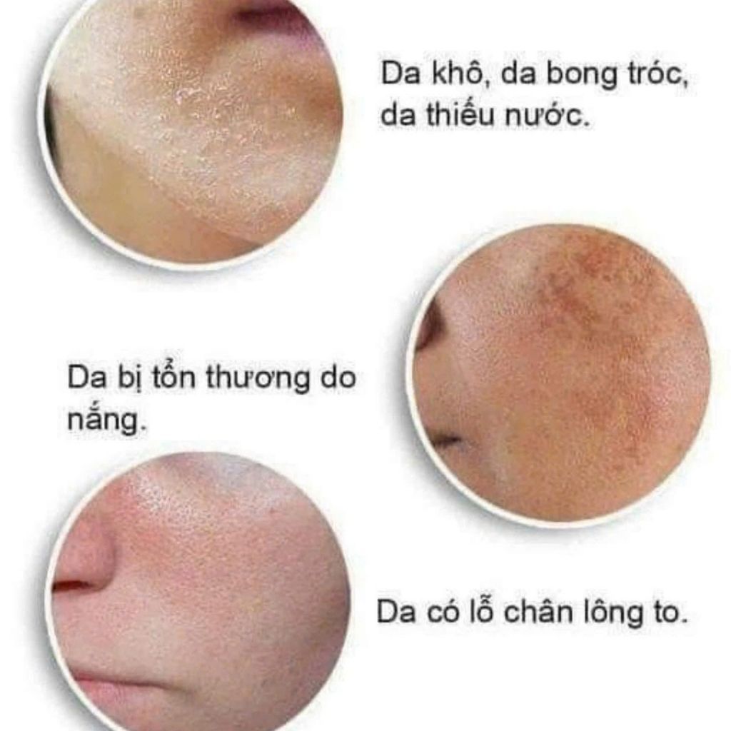 Serum B5 Pretty Skin cấp ẩm dưỡng trắng BKHEKR-9177
