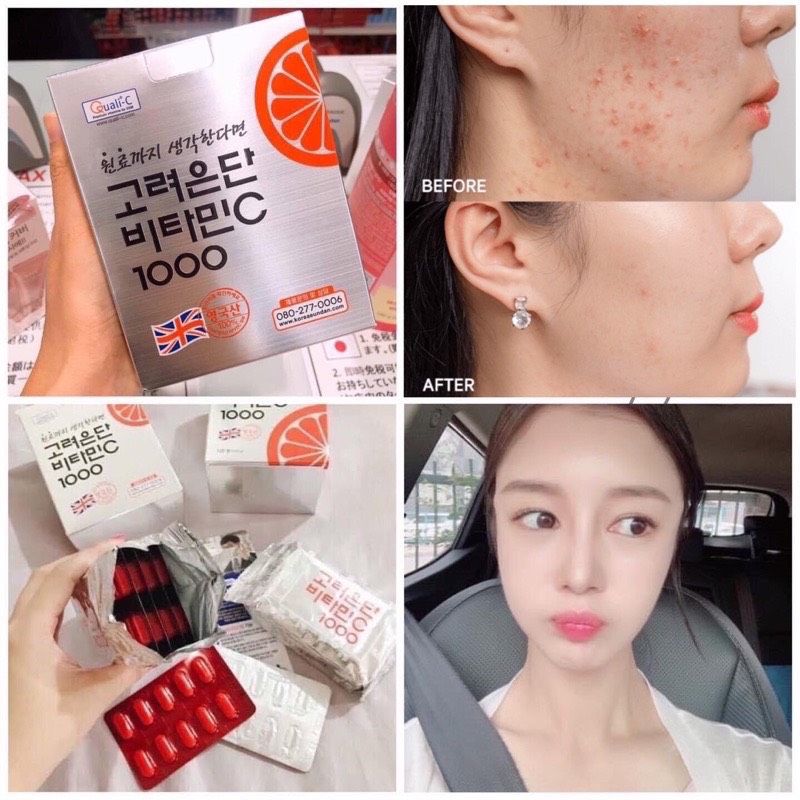 Viên uống Vitamin C 1000mg Korea Eundan