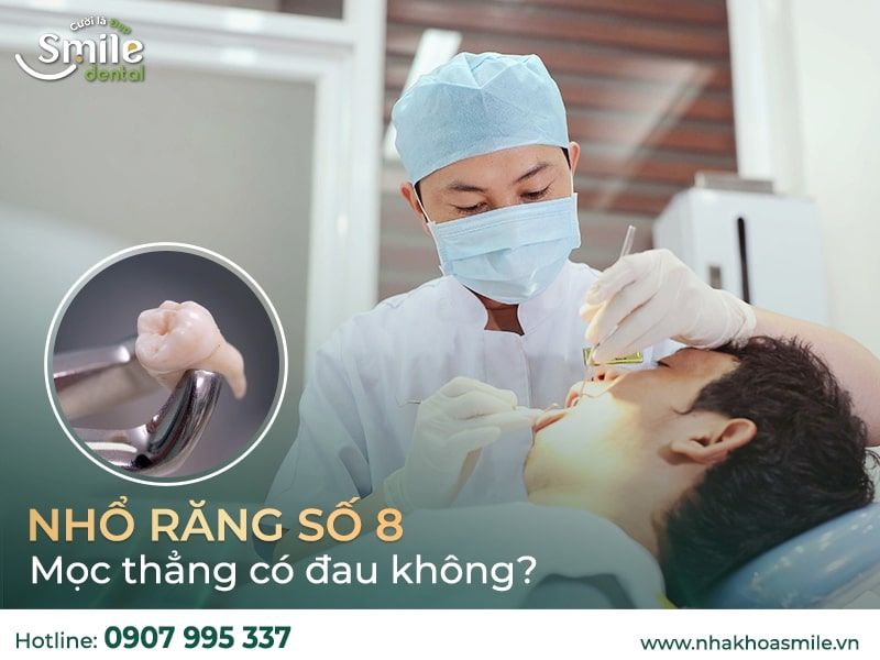 Nhổ răng số 8 thẳng