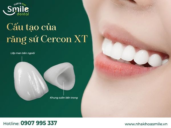 Dịch vụ phục hình bọc sứ Cercon XT là gì? Giá thành của răng sứ Cercon XT hiện nay là bao nhiêu?