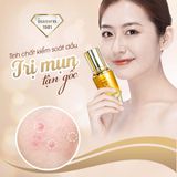  Tinh Chất ức chế Mụn Kiểm Soát Dầu Isamen-30ml (Cleaning Skin Acne Essence) 