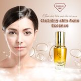  Tinh Chất ức chế Mụn Kiểm Soát Dầu Isamen-30ml (Cleaning Skin Acne Essence) 