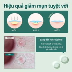 Some By Mi Miếng dán mụn Clear Spot Patch