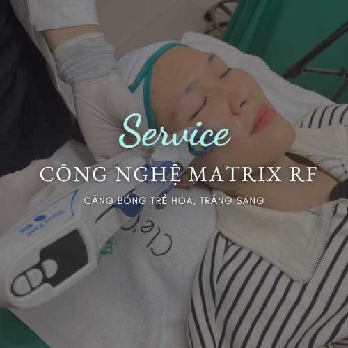  Công nghệ matrix RF 