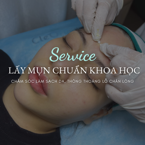  Kỹ Thuật Lấy Nhân Mụn Bằng Tăm Bông Chuẩn Y Khoa 