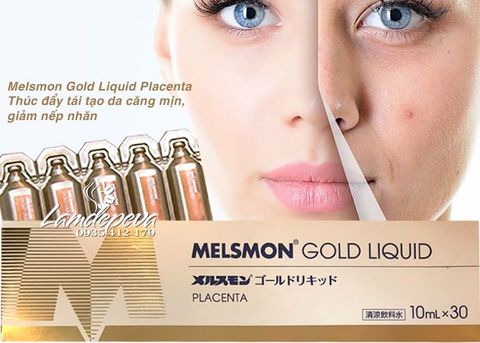 Nước uống Nhau thai Ngựa MELSMON Gold Liquid - 30 ống