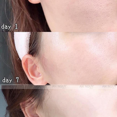 Dung Dịch Tẩy Tế Bào Chết Obagi BHA 2% Clenziderm MD Pore Therapy