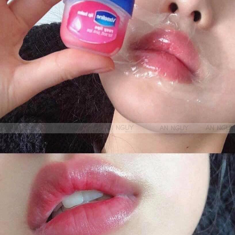 Sáp Dưỡng Môi Vaseline Lip Therapy Dưỡng Môi Hồng Hào